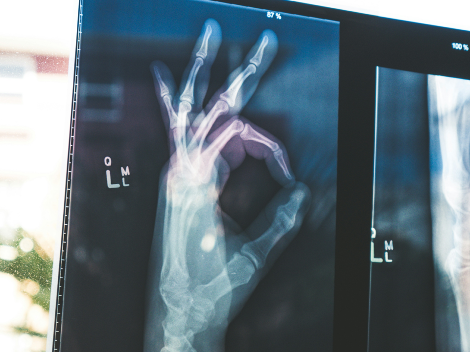 X ray of hand giving the OK sign